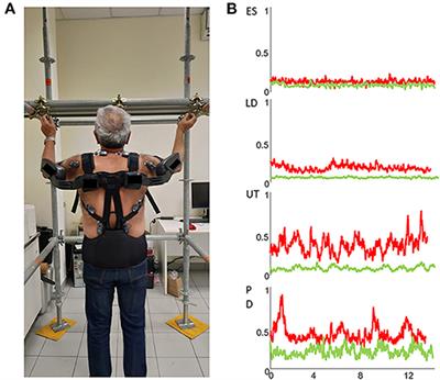 Critical Issues and Imminent Challenges in the Use of sEMG in Return-To-Work Rehabilitation of Patients Affected by Neurological Disorders in the Epoch of Human–Robot Collaborative Technologies